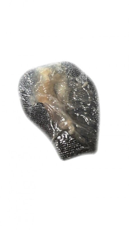 แบบนี้ควรไปหาหมอมั้ยค่ะ