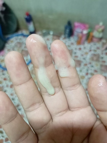 วันนี้40พอดีไปหาหมอตรวจมดลูกแต่ก็ยังไม่เปิดแต่พอกลับมาบ้านช่วง2ทุ่มกำลังจะอาบน้ำมีหมูกไหลออกมาแบบนี้