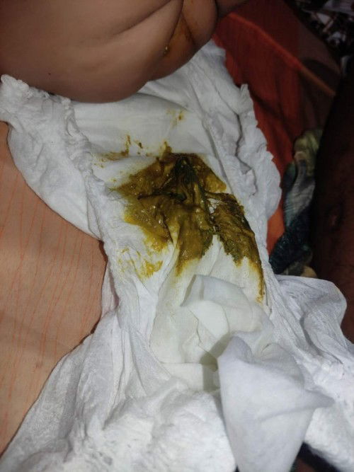 Basa na poop Color Yellow and Dark Green?