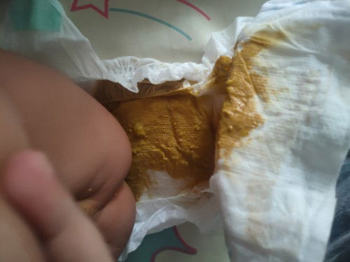 ลูกถ่ายเหลว