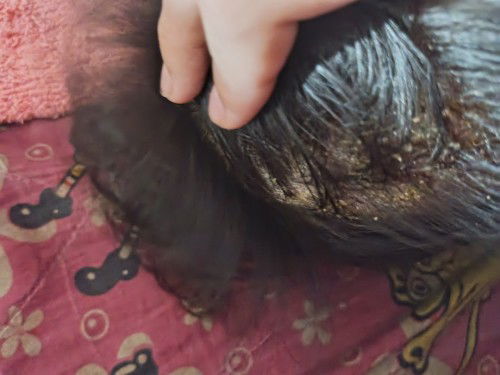 Hello gm!nagbabalakubak po ksi uli ng bbyko kapag nililinisan tpos kpag nililinasan sya nagtutubig.