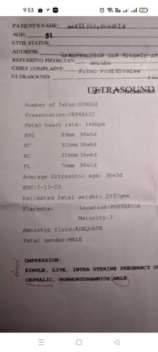 Placenta maturity 3 posterior