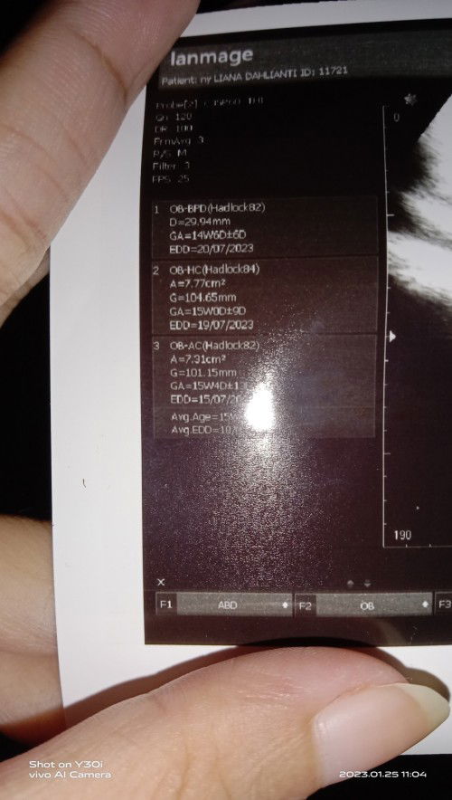 Cara membaca Hasil USG