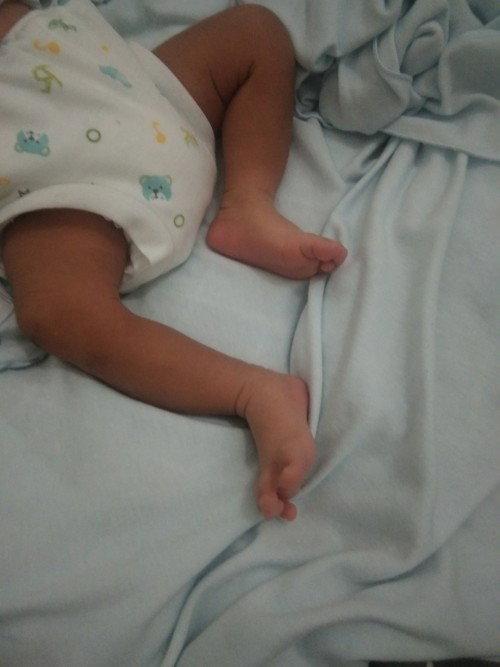 Posisi kaki bayi