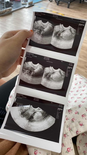 Scan 6w3d