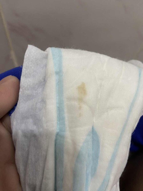 Discharge yellow 5 weeks pregnant