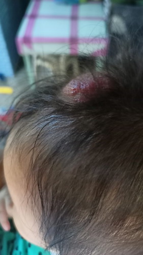 Bakit po kaya ganto bunbunan ng anak ng kapitbahay namin?