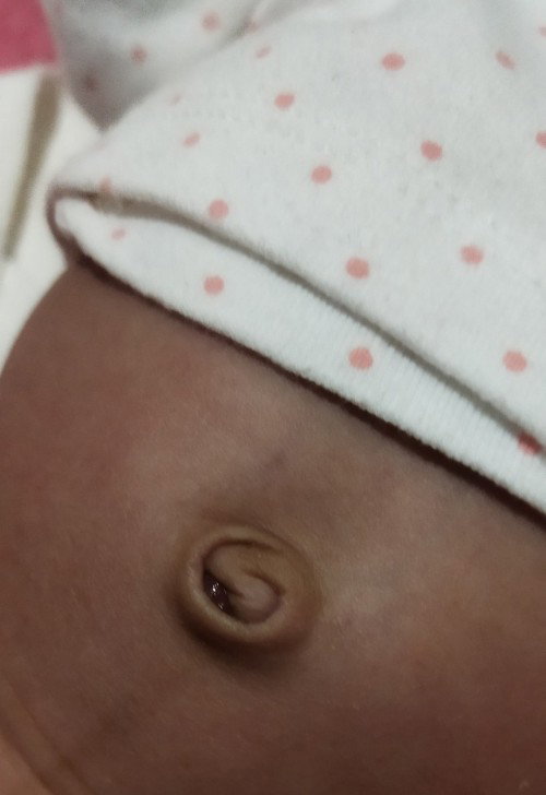 pusod ni baby