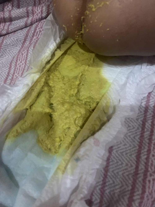 3 months and 3 weeks baby POOP