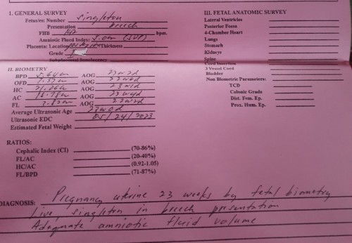 FHB may kinalaman ba sa gender ni baby?