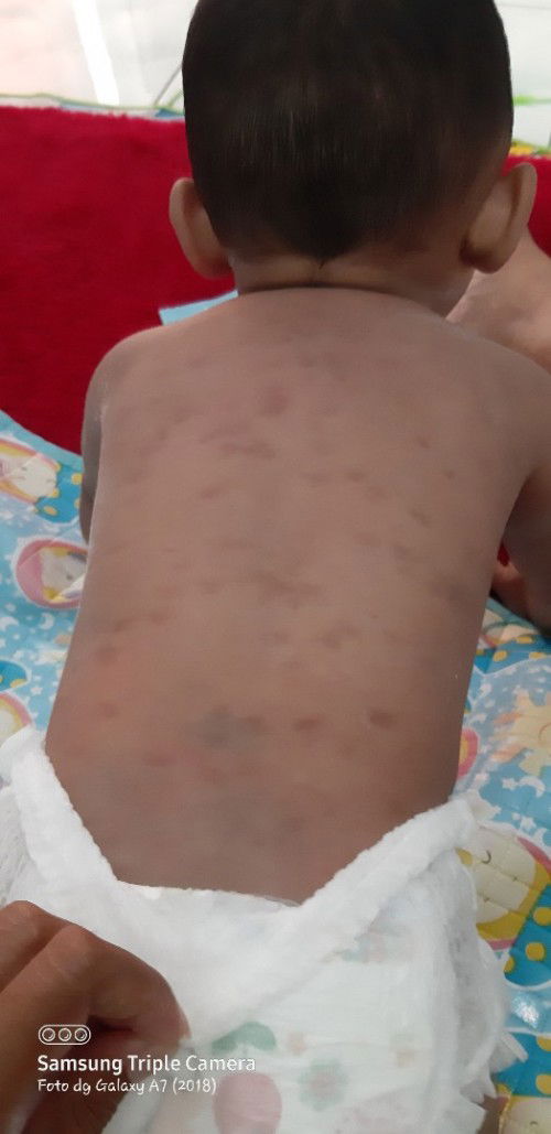 Bun ada yang pernah kyk gini gak anknya