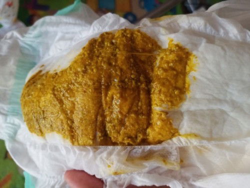 น้องขับถ่ายแบบนี้