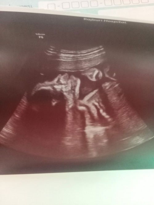 ลูกสาวคนแรก