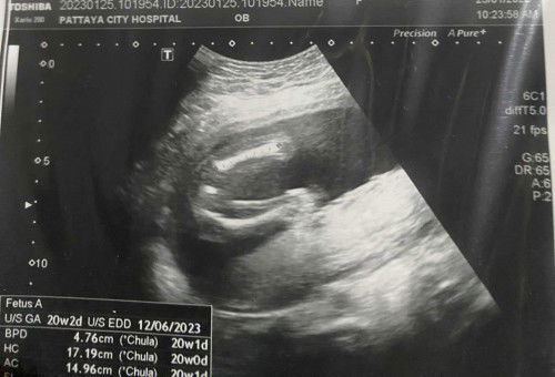 ช่วยดูหน่อยค่ะแม่ๆ🥺