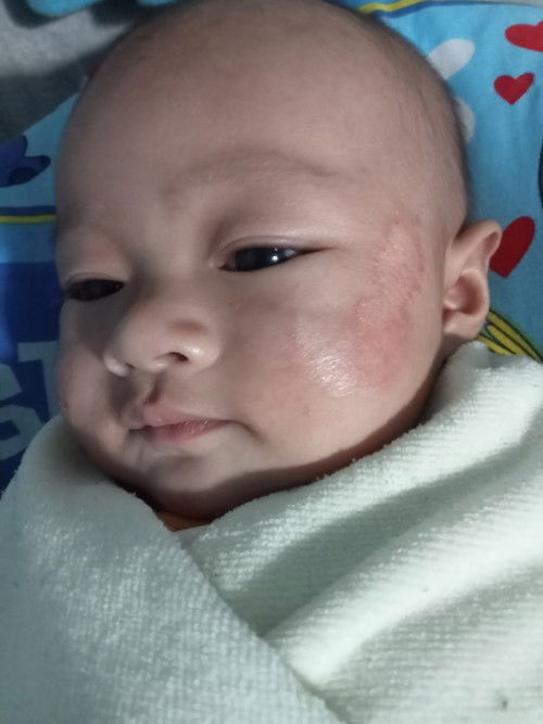 หน้าน้องเป็นอะไรคะ