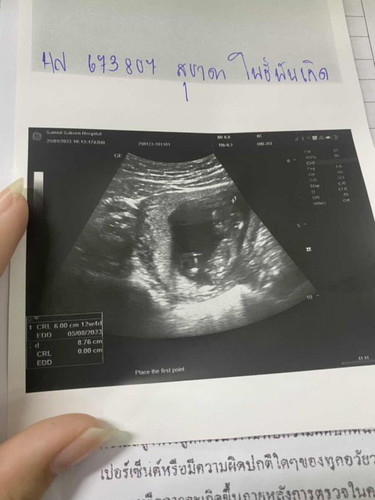 12week4day💖