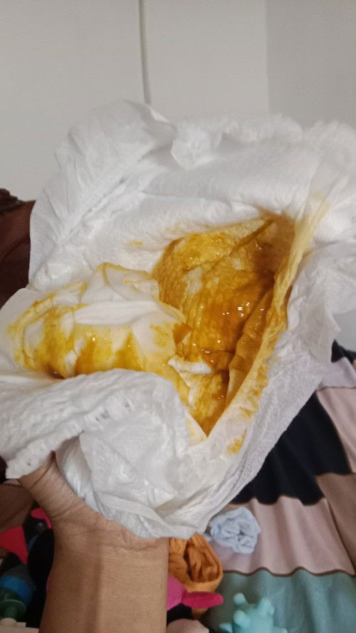 BAB BABY 5 BULAN BERLENDIR (BELUM MPASI)