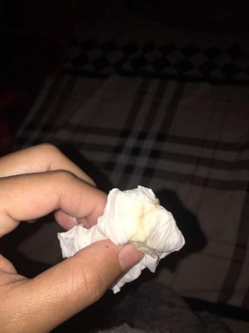 Lendir coklat/bercampur darah