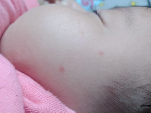 ลูกมีจุดแดงบนหน้า