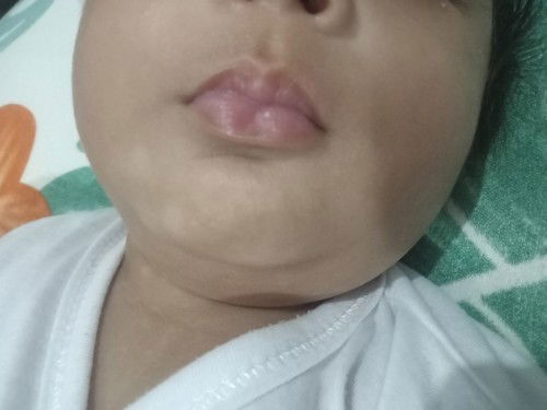 An-an o puti puti dahil yata sa gatas ko