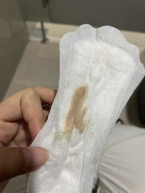 Keputihan Banyak Hamil Usia 18Weeks