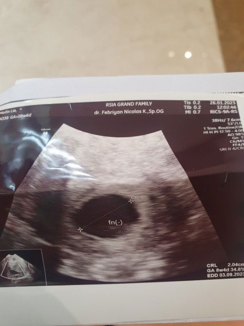 7 minggu tp masih kantong, ada yang punya pengalaman yang sama