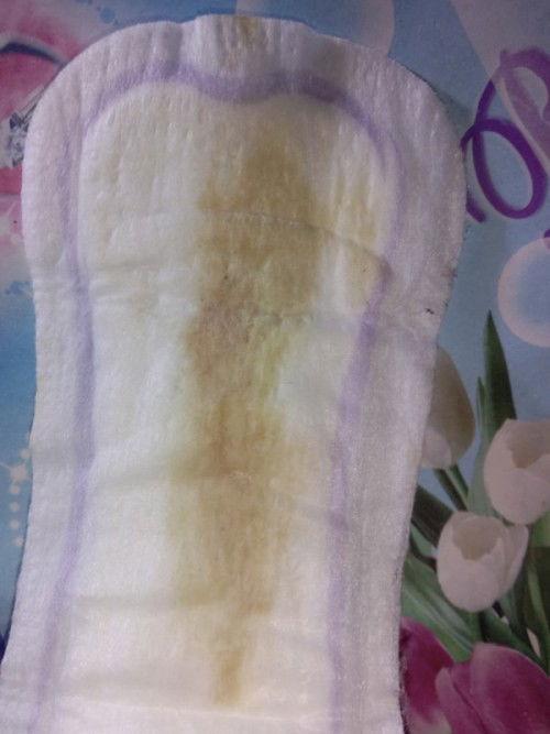 Knpa ye kluar mcm ni sy dh 38weeks risau pula tiba2 kluar mcm ni maaf kotor sikit first bby tak tau