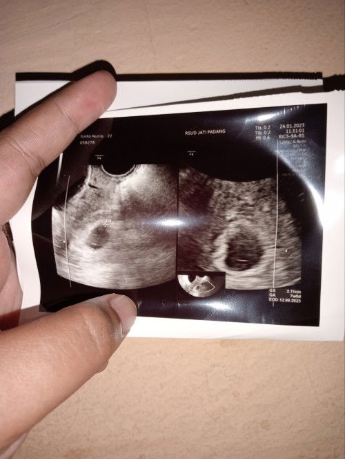 Assalamualaikum bunda"