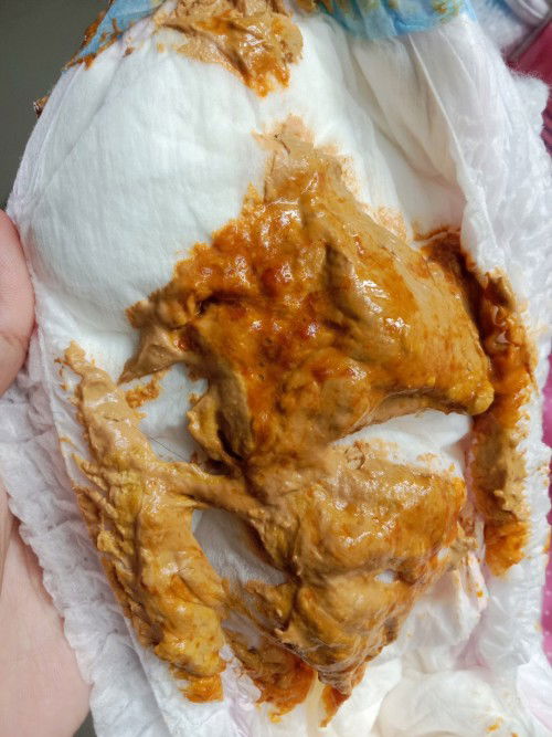 ลุกอึสีเหลืองปนสีส้ม