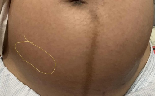 24weeks preggy