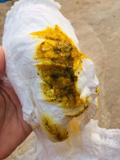 ตัวเล็กบ้านนี้ถ่ายแบบนี้เป็นอะไรไหมคะ น้องได้2เดือน 8วัน