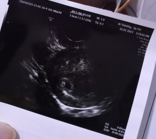 Ada yang bisa baca hasil USG