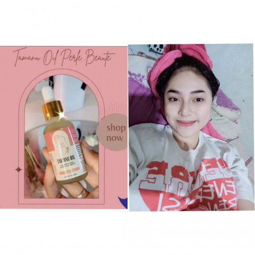 Tamanu oil apakah aman untuk bumil