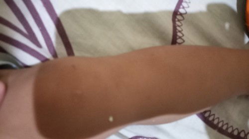 Krim baby untuk bekas luka