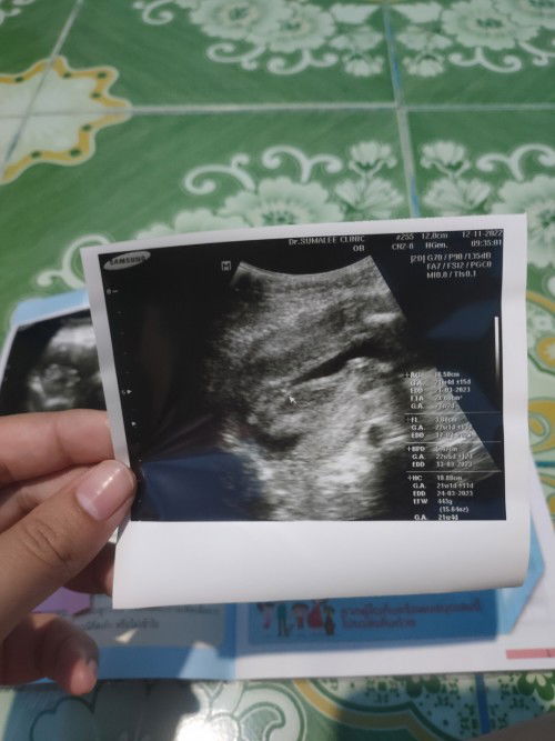 แม่ๆ??
ช่วยดูให้ทีค่ะว่าน้องเป็นผญ.หรือผช.ค้ะ ขอบคุณค่ะ🙏🙏🙏