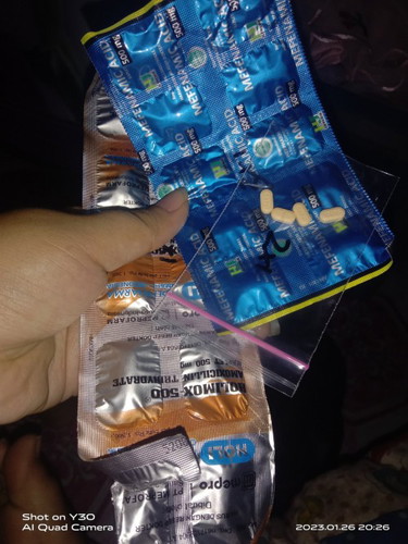 Sakit gusi