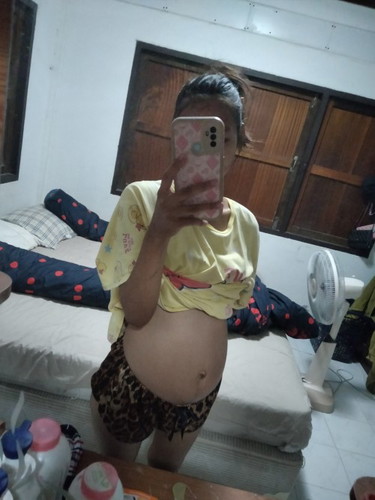 ตั้งครรภ์24วีค+5 ลูกสาวค่ะ