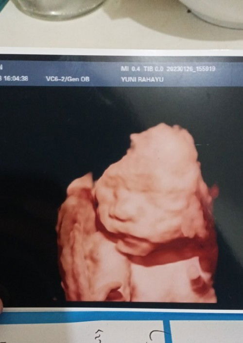 Jenis kelamin bisa berubah?