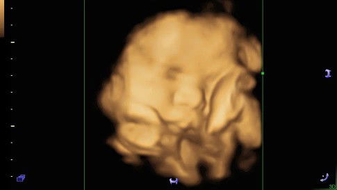 36 minggu berat badan bayi normal nya brpa?