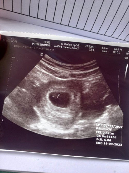 7week tapi masih berupa kantung
