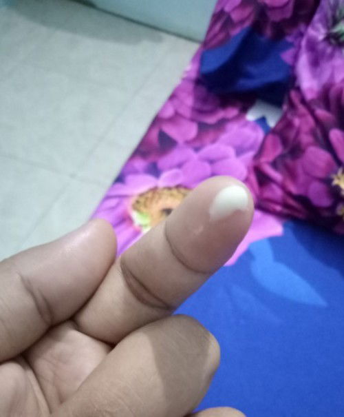 Maaf bun agk jorok,  normal gk bun hamil 38 minggu keluar keputihan kaya susu?