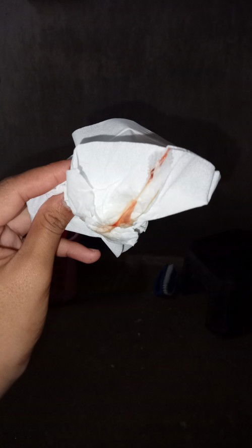 ฝังเข็มยาคลุมกำเนิด