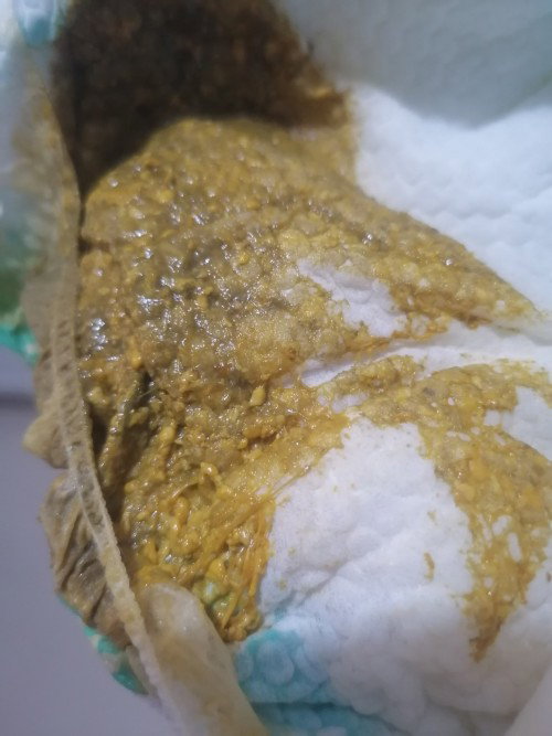 Mga mii, normal lng po ba ito o may sipon po sa poop ni baby? FTM here.