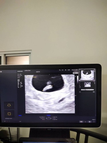 จากที่เครียดมาเต็มๆ 2 อาทิตย์