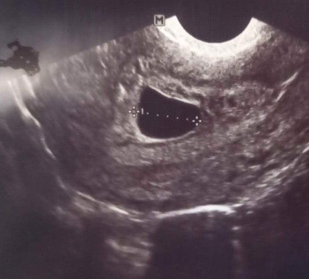 7 วีค ไม่เห็นตัวเด็ก