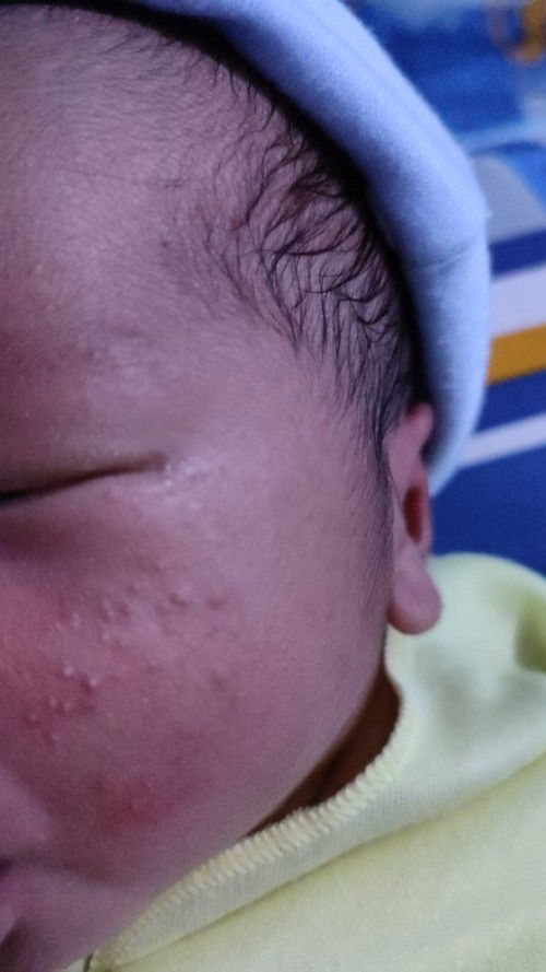 Assalamu'alaikum bun selamat pagi.. 
Aku mau tanya bun cream wajah baby yg bagus untuk mengat