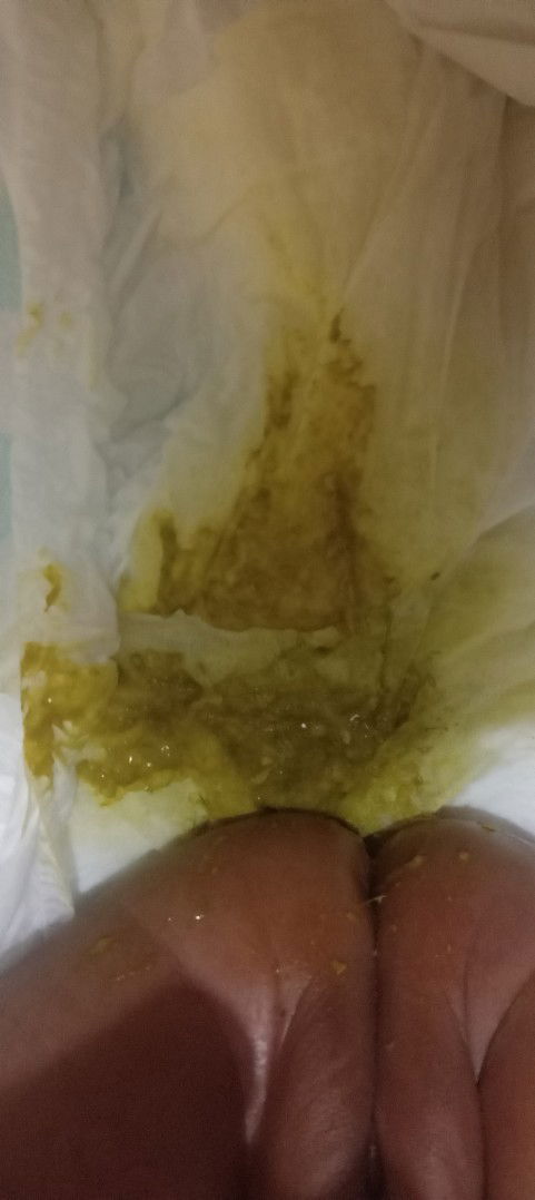 Pup bayi warna ijo bayi asi usia 1 bulan bunda², mau tanyaa apa aman?  Asalnya kuning cerah..