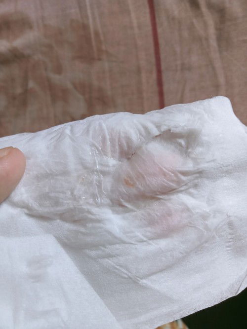 Lendir ada bercak darah