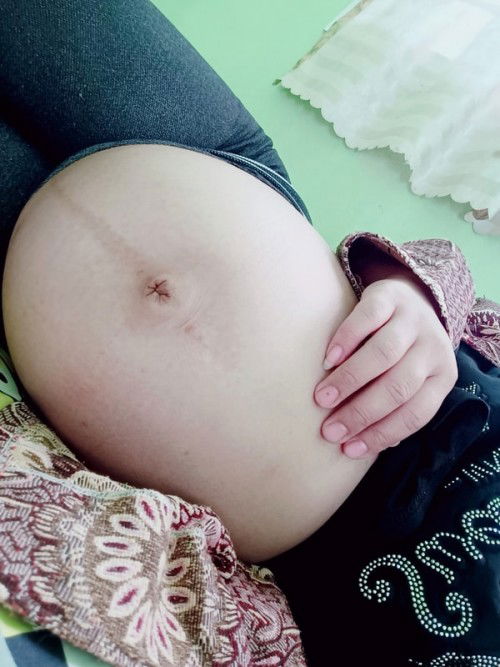 สวัสดีค่ะ แม่ๆทุกคน ท้องนี้ท้องเป็นท้องที่สองของเรา อยากบอกว่าท้องนี้ลำบากมาก ไม่สบายตัวเลย