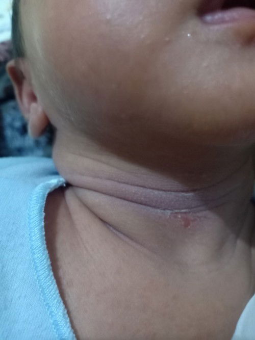 Penyebab bau badan bayi